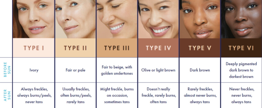 The Fitzpatrick Scale